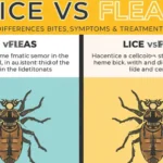 Lice vs Fleas
